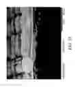 Fig. 22 - Conformable Microporous Fiber and Woven Fabrics Containing Same