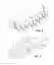 Fig. 05 - Ground engaging tooth assemblies