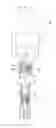 Fig. 12 - POST-INSTALLED ANCHOR, METHOD FOR INSTALLING POST-INSTALLED ANCHOR, POST-INSTALLED ANCHOR SYSTEM, AND ROTATION PREVENTING JIG