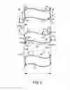 Fig. 06 - Covering for architectural openings with coordinated vane sets