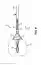 Fig. 09 - Drill string inground isolator in an MWD system and associated method