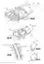 Fig. 05 - Low turn loss baffle flow diverter