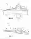 Fig. 03 - LOCK-UP PREVENTION VANE FOR VARIABLE GEOMETRY TURBOCHARGER