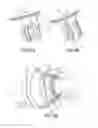 Fig. 06 - Assembly for aircraft turbine engine and method for mounting same