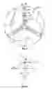 Fig. 07 - Torsional vibration absorption system
