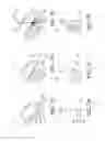 Fig. 08 - Light emitting module with lens