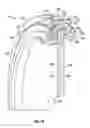 Fig. 11 - Orifice plate assembly