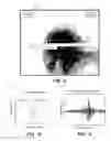 Fig. 07 - Multi-sensor inspection for identification of pressurized pipe defects that leak