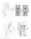 Fig. 13 - Cartridges, kits, and methods for enhanced detection and quantification of analytes
