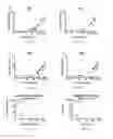 Fig. 49 - METHODS OF DIAGNOSING CELIAC DISEASE USING IP-10