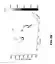 Fig. 05 - Antibiotic susceptibility testing via plasmonic imaging and tracking