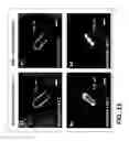 Fig. 20 - Antibiotic susceptibility testing via plasmonic imaging and tracking
