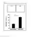 Fig. 04 - Method for predicting prognosis of acute myeloid leukemia relapse
