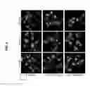 Fig. 06 - COMPOSITIONS AND METHODS FOR TREATING SUBJECTS WITH IMMUNE-MEDIATED DISEASES