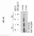 Fig. 13 - COMPOSITIONS AND METHODS FOR TREATING SUBJECTS WITH IMMUNE-MEDIATED DISEASES