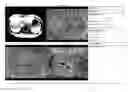 Fig. 01 - Comprehensive cardiovascular analysis with volumetric phase-contrast MRI