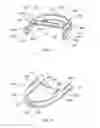 Fig. 07 - Inverted cable storage device