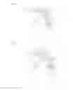Fig. 07 - Spectacle lens for a display device that can be fitted on the head of a user and generates an image, and display device with such a spectacle lens