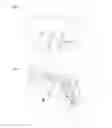 Fig. 09 - Spectacle lens for a display device that can be fitted on the head of a user and generates an image, and display device with such a spectacle lens