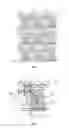 Fig. 04 - Array substrate and manufacturing method thereof, and display device