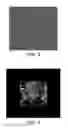 Fig. 04 - Image phase retrieval