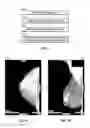 Fig. 06 - DATABASE SYSTEMS AND INTERACTIVE USER INTERFACES FOR DYNAMIC INTERACTION WITH, AND COMPARISON OF, DIGITAL MEDICAL IMAGE DATA