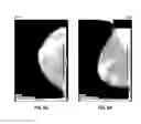 Fig. 07 - DATABASE SYSTEMS AND INTERACTIVE USER INTERFACES FOR DYNAMIC INTERACTION WITH, AND COMPARISON OF, DIGITAL MEDICAL IMAGE DATA