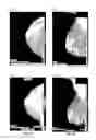 Fig. 09 - DATABASE SYSTEMS AND INTERACTIVE USER INTERFACES FOR DYNAMIC INTERACTION WITH, AND COMPARISON OF, DIGITAL MEDICAL IMAGE DATA