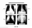 Fig. 14 - DATABASE SYSTEMS AND INTERACTIVE USER INTERFACES FOR DYNAMIC INTERACTION WITH, AND COMPARISON OF, DIGITAL MEDICAL IMAGE DATA