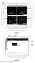 Fig. 17 - DATABASE SYSTEMS AND INTERACTIVE USER INTERFACES FOR DYNAMIC INTERACTION WITH, AND COMPARISON OF, DIGITAL MEDICAL IMAGE DATA