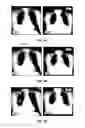 Fig. 19 - DATABASE SYSTEMS AND INTERACTIVE USER INTERFACES FOR DYNAMIC INTERACTION WITH, AND COMPARISON OF, DIGITAL MEDICAL IMAGE DATA