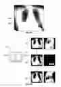Fig. 20 - DATABASE SYSTEMS AND INTERACTIVE USER INTERFACES FOR DYNAMIC INTERACTION WITH, AND COMPARISON OF, DIGITAL MEDICAL IMAGE DATA