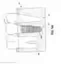 Fig. 06 - Coordination of dental implant information