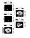 Fig. 18 - Systems and Methods for Behavior Detection Using 3D Tracking and Machine Learning