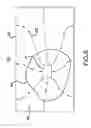 Fig. 05 - Coaxial transmission line including electrically thin resistive layer and associated methods