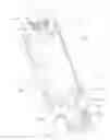 Fig. 01 - Outer sleeve for CATV filter