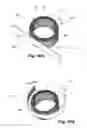 Fig. 33 - Electrical machine stator with small input radius, and corresponding method for production of the stator