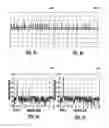 Fig. 04 - Power supply for multiphase motor providing recirculation compensation features and related methods