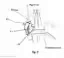 Fig. 03 - Sound system with ear device with improved fit and sound