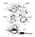 Fig. 04 - Sound system with ear device with improved fit and sound