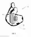 Fig. 07 - Sound system with ear device with improved fit and sound