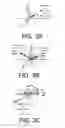 Fig. 06 - Binaural hearing assistance system comprising binaural noise reduction