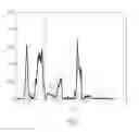 Fig. 02 - Enhanced dynamics processing of streaming audio by source separation and remixing