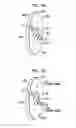 Fig. 04 - Medical device coupling arrangement
