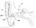 Fig. 01 - Ear mold for auditory device