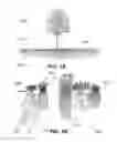 Fig. 02 - SYSTEMS, METHODS, AND APPARATUSES FOR ROOT DEVELOPMENT