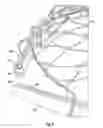 Fig. 05 - Lighted Fish Landing Net