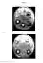 Fig. 09 - Antimicrobial compositions