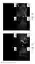 Fig. 09 - Nanoparticle-stabilized microcapsules, dispersions comprising nanoparticle-stabilized microcapsules, and method for the treatment of bacterial biofilms