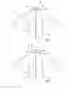 Fig. 02 - REMOVABLY ATTACHABLE GARMENT COMPONENTS AND GARMENT COMPRISING SAME
